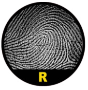 Nước ngược (Radial Loop) - R